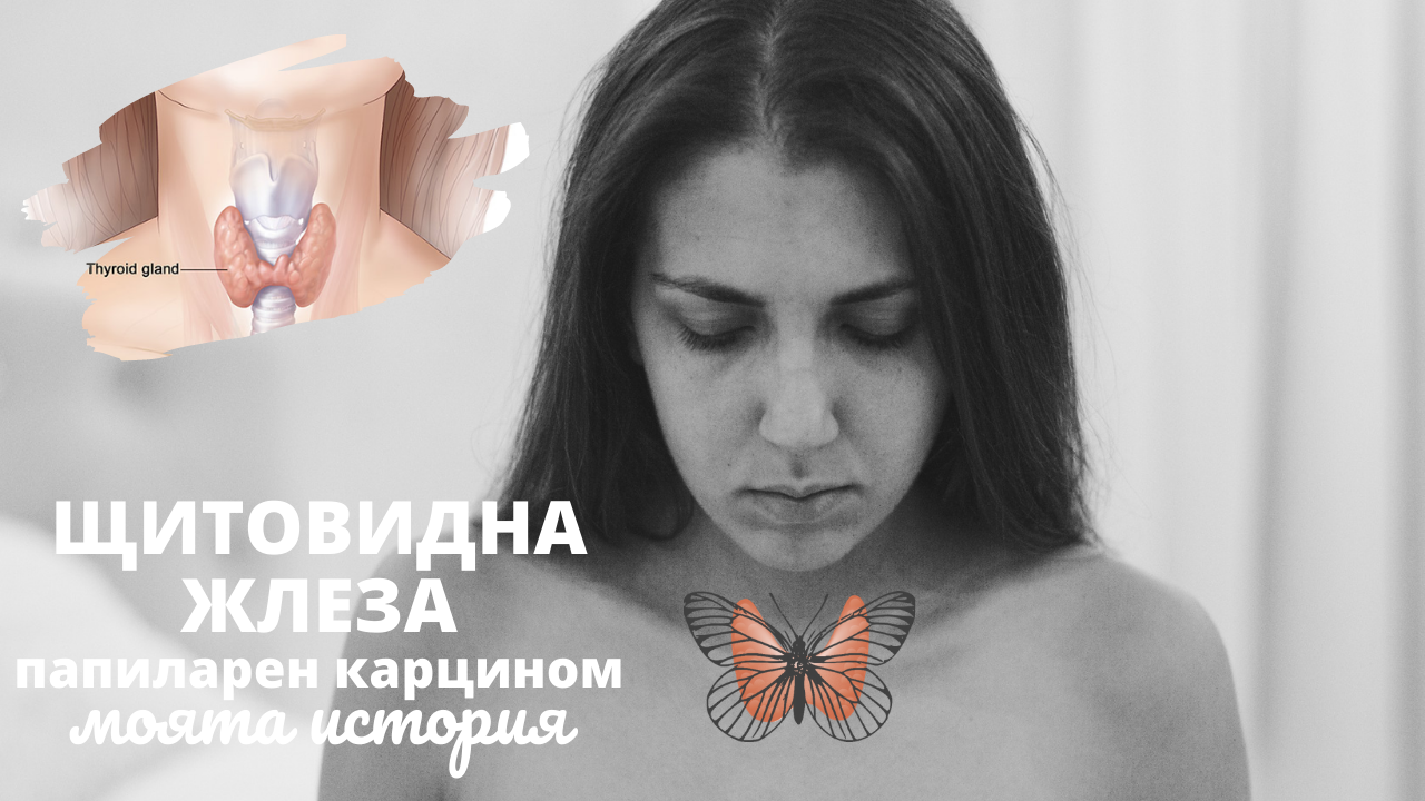 Моята история